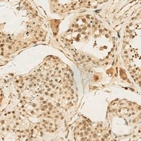 CNOT4 Antibody
