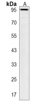PKN3 Rabbit Polyclonal Antibody