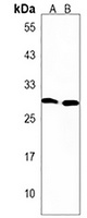 HOXC9 Rabbit Polyclonal Antibody