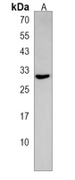 CELA2A Rabbit Polyclonal Antibody