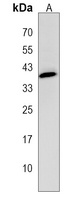 GDPD3 Rabbit Polyclonal Antibody
