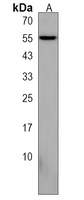 DEF8 Rabbit Polyclonal Antibody