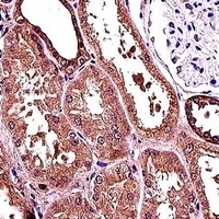 RANBP3L Rabbit Polyclonal Antibody