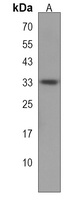 TRIM34 Rabbit Polyclonal Antibody