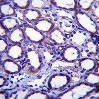 TRIM34 Rabbit Polyclonal Antibody