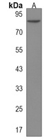 USP45 Rabbit Polyclonal Antibody