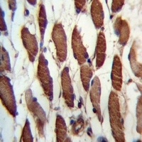 USP45 Rabbit Polyclonal Antibody
