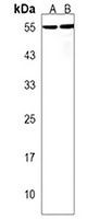 PRCP Rabbit Polyclonal Antibody