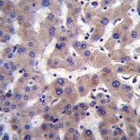 PRCP Rabbit Polyclonal Antibody