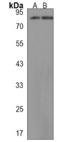 KCTD3 Rabbit Polyclonal Antibody