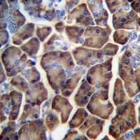 KCTD3 Rabbit Polyclonal Antibody