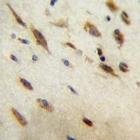 CCDC134 Rabbit Polyclonal Antibody