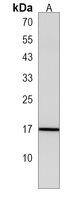 GPHB5 Rabbit Polyclonal Antibody