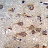 GPHB5 Rabbit Polyclonal Antibody
