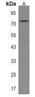 RNF43 Rabbit Polyclonal Antibody