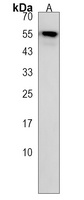 PALMD Rabbit Polyclonal Antibody
