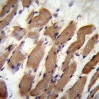 PALMD Rabbit Polyclonal Antibody