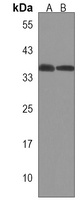 LUZP2 Rabbit Polyclonal Antibody