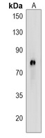 CAPN8 Rabbit Polyclonal Antibody