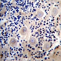 REPS2 Antibody