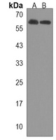 LZTS1 Rabbit Polyclonal Antibody
