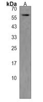 MPP3 Rabbit Polyclonal Antibody