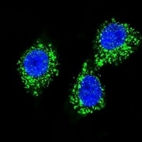 MPP3 Rabbit Polyclonal Antibody