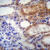 SUSD2 Rabbit Polyclonal Antibody