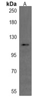 PLEKHM1 Rabbit Polyclonal Antibody