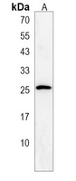 CCDC90B Rabbit Polyclonal Antibody