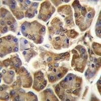 CCDC90B Rabbit Polyclonal Antibody