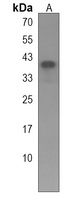 PGA4 Rabbit Polyclonal Antibody