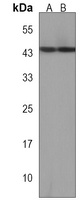 DUX4 Rabbit Polyclonal Antibody