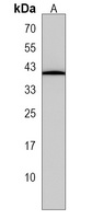 SP6 Rabbit Polyclonal Antibody