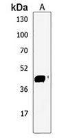 GAL3ST4 Rabbit Polyclonal Antibody