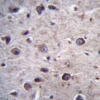DOC2A Rabbit Polyclonal Antibody