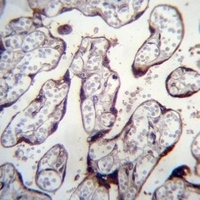 LOXL3 Rabbit Polyclonal Antibody