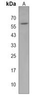 MATN1 Rabbit Polyclonal Antibody