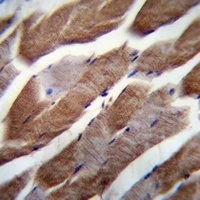 MATN1 Rabbit Polyclonal Antibody