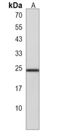 RPL15 Antibody