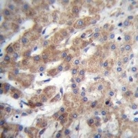 FGFR5 Rabbit Polyclonal Antibody