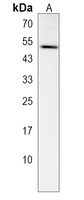 GTPBP10 Rabbit Polyclonal Antibody
