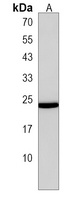 TM4SF1 Rabbit Polyclonal Antibody