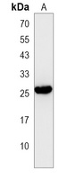 LRRN4CL Rabbit Polyclonal Antibody