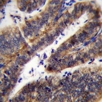 LRRN4CL Rabbit Polyclonal Antibody