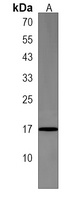 CCDC58 Rabbit Polyclonal Antibody