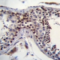 CCDC58 Rabbit Polyclonal Antibody