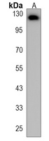 KIAA1324 Rabbit Polyclonal Antibody
