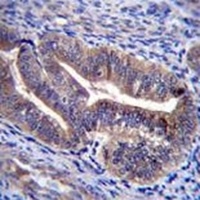 KIAA1324 Rabbit Polyclonal Antibody