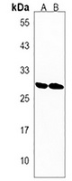 DHRS4L1 Rabbit Polyclonal Antibody